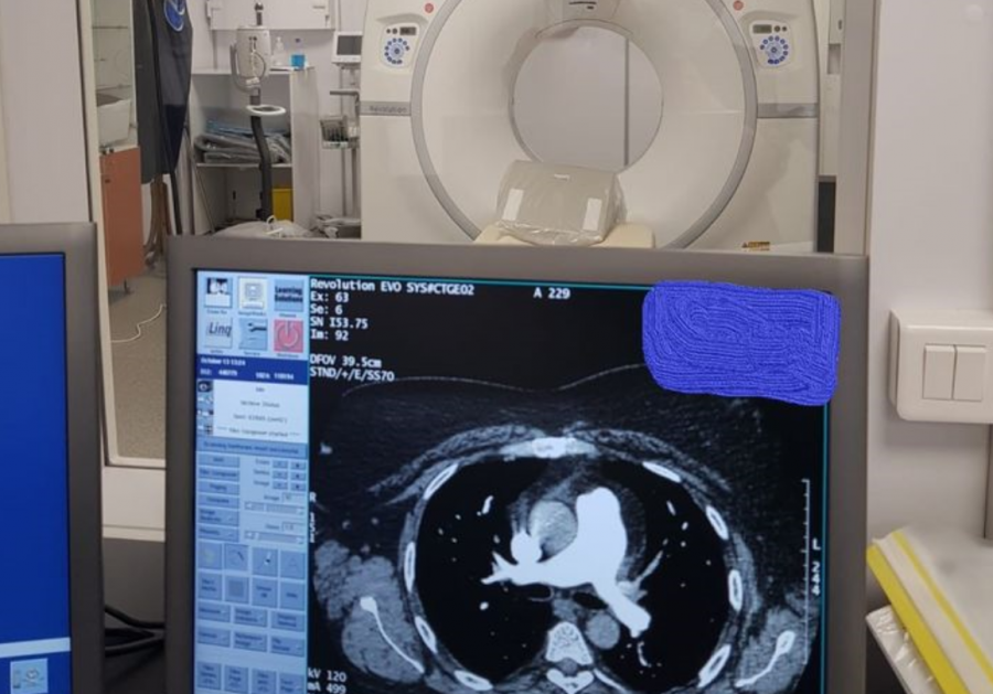 Computerul Tomograf de la Județean, folosit la intensitate maximă. 95 de pacienți COVID-19 au fost investigați în doar două zile