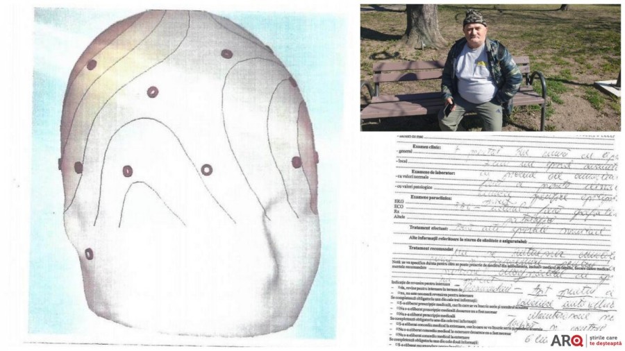 Preşedintele Composesoratului Vidra de la Vârfurile a rămas fără permis pe motiv de... sindrom epileptic; bărbatul susţine că i se trage de la o vecină care vrea să-i ia locul