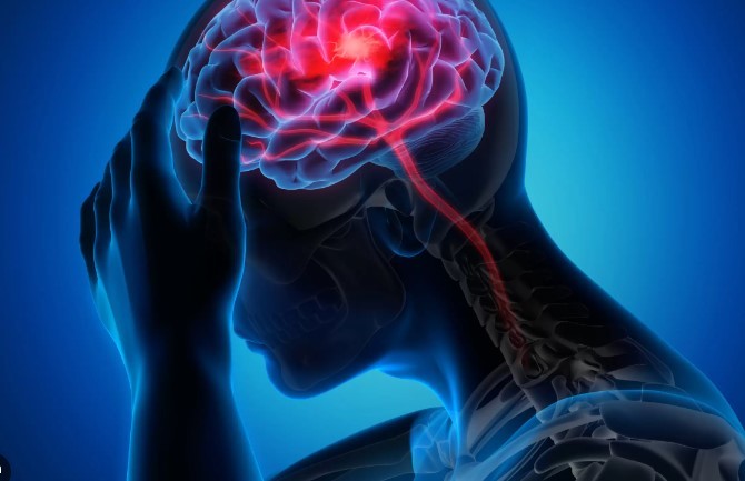 Accidentul Vascular Cerebral: O Alarmă pentru Sănătatea Publică